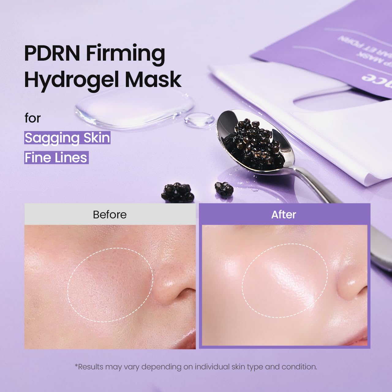 BIODANCE Rejuvenating Caviar PDRN Real Deep Mask, Overnight Hydrogel Face Mask, Skin Firming, Radiance, Enhancing Skin Recovery, Korean Skin Care | 1.19oz(34g) x 4ea 3