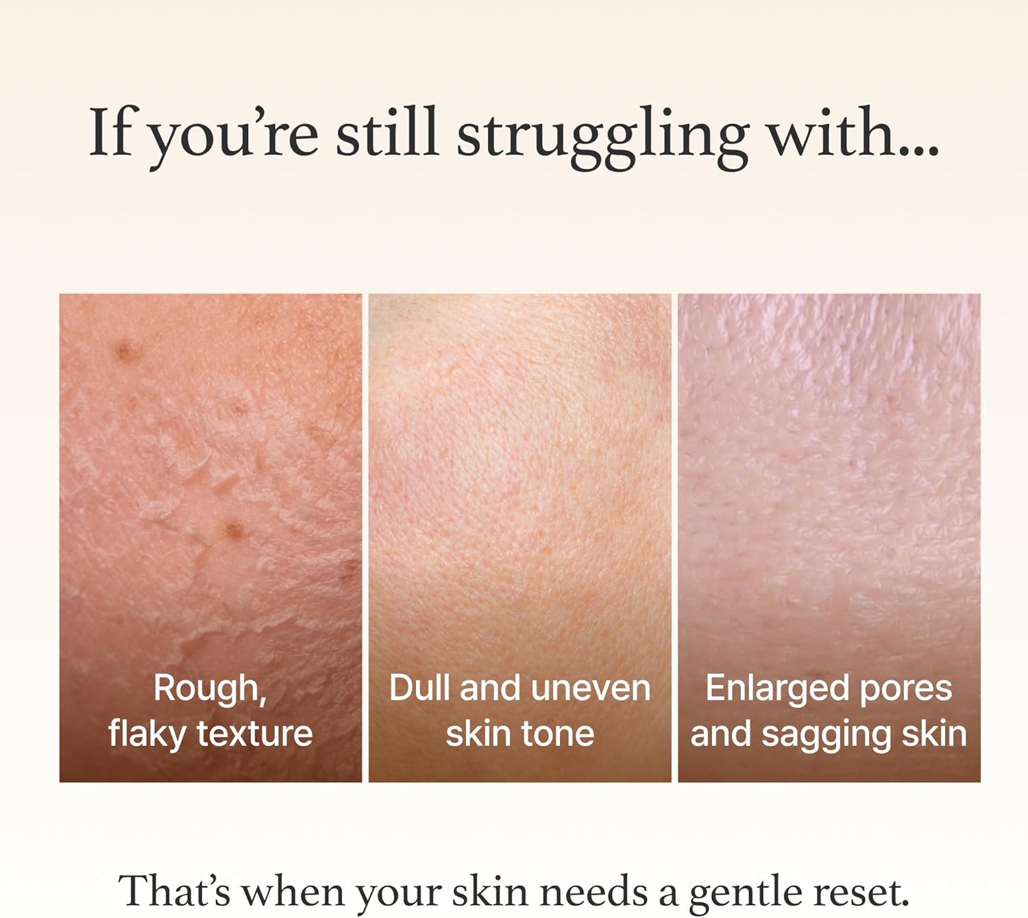 I'm From, Rice Mask 3