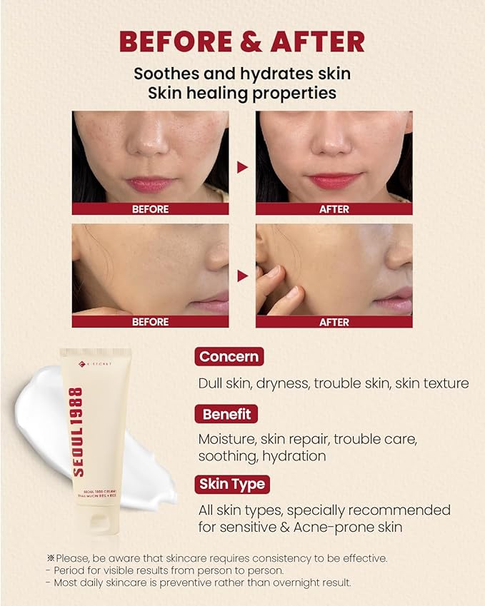 K-SECRET SEOUL 1988 Snail Mucin 93% Cream  2