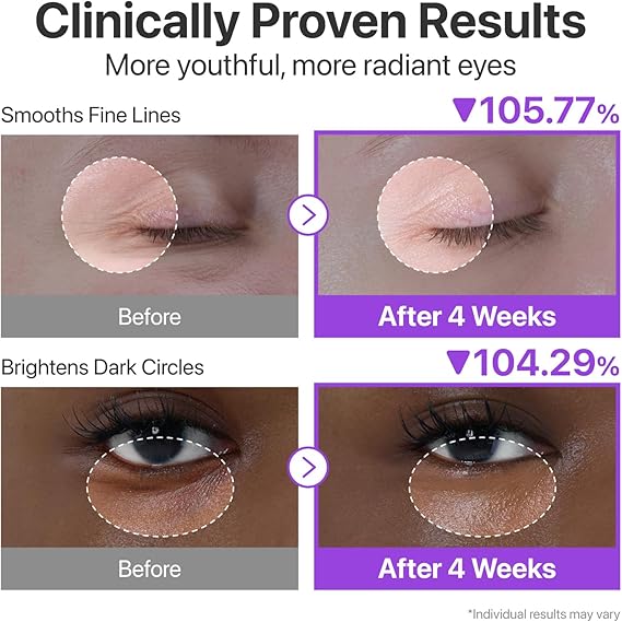 numbuzin No.9 Eye Cream | NAD+ Retinol Volume Eye Cream  3