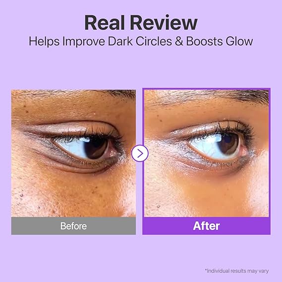 numbuzin No.9 Eye Cream | NAD+ Retinol Volume Eye Cream  2