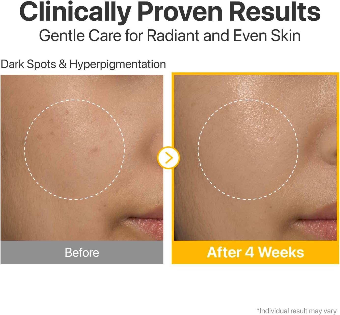 numbuzin No.5 Serum | Glutathione Vitamin Concentrated Serum 4