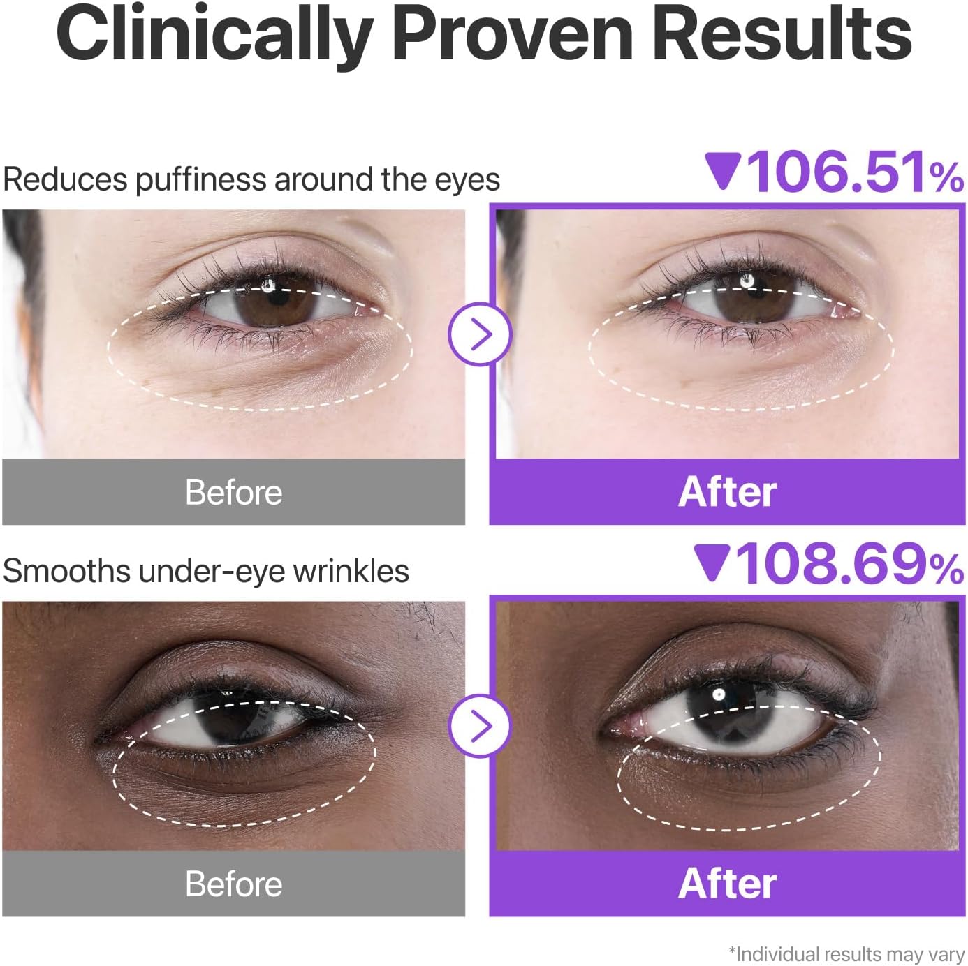 numbuzin No.9 Eye Patches | NAD+ Collagen Under Eye Patches  3