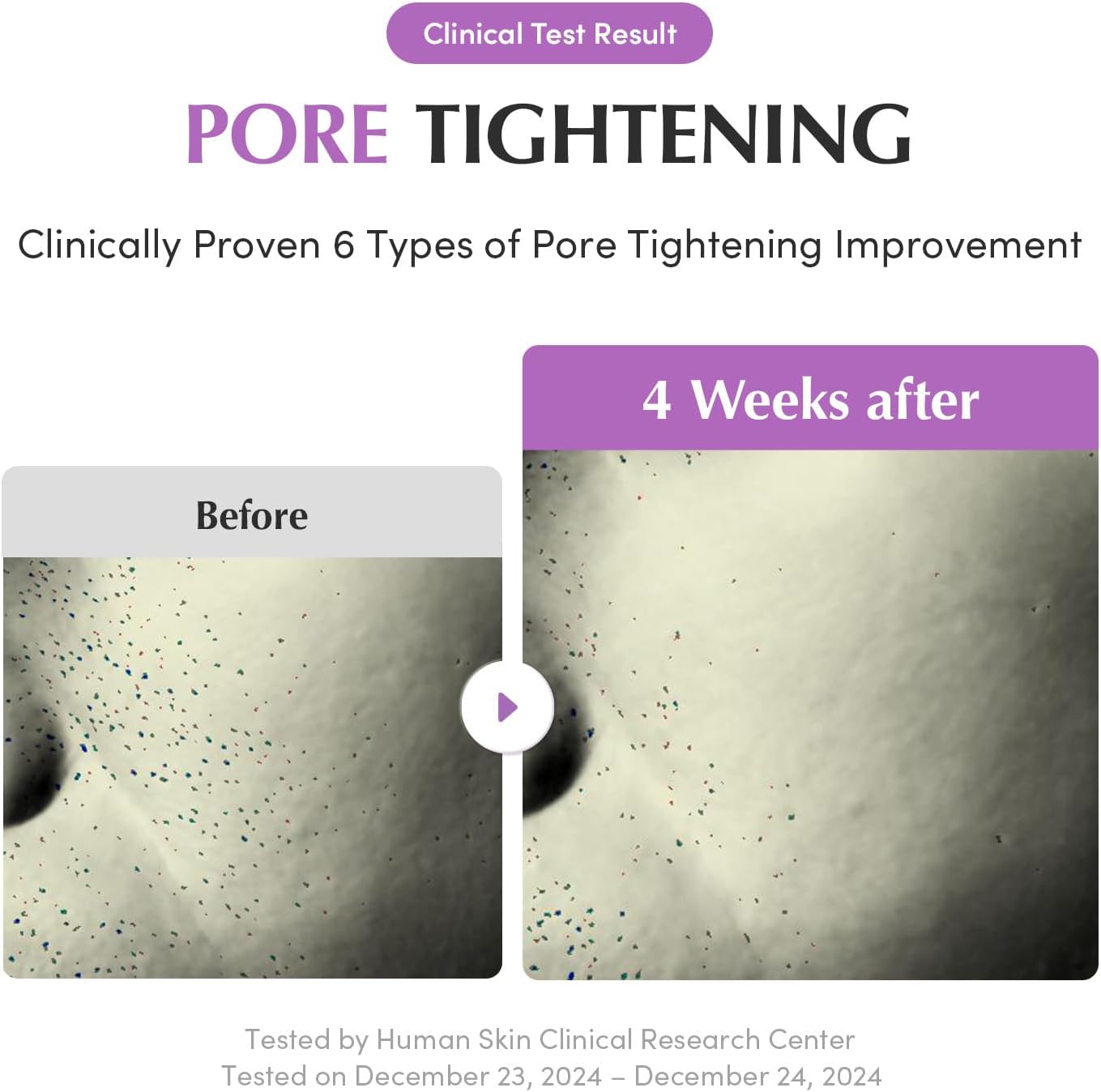 EQQUALBERRY Purple PDRN Pore Minimising Serum - Vegan Collagen & Peptides  4