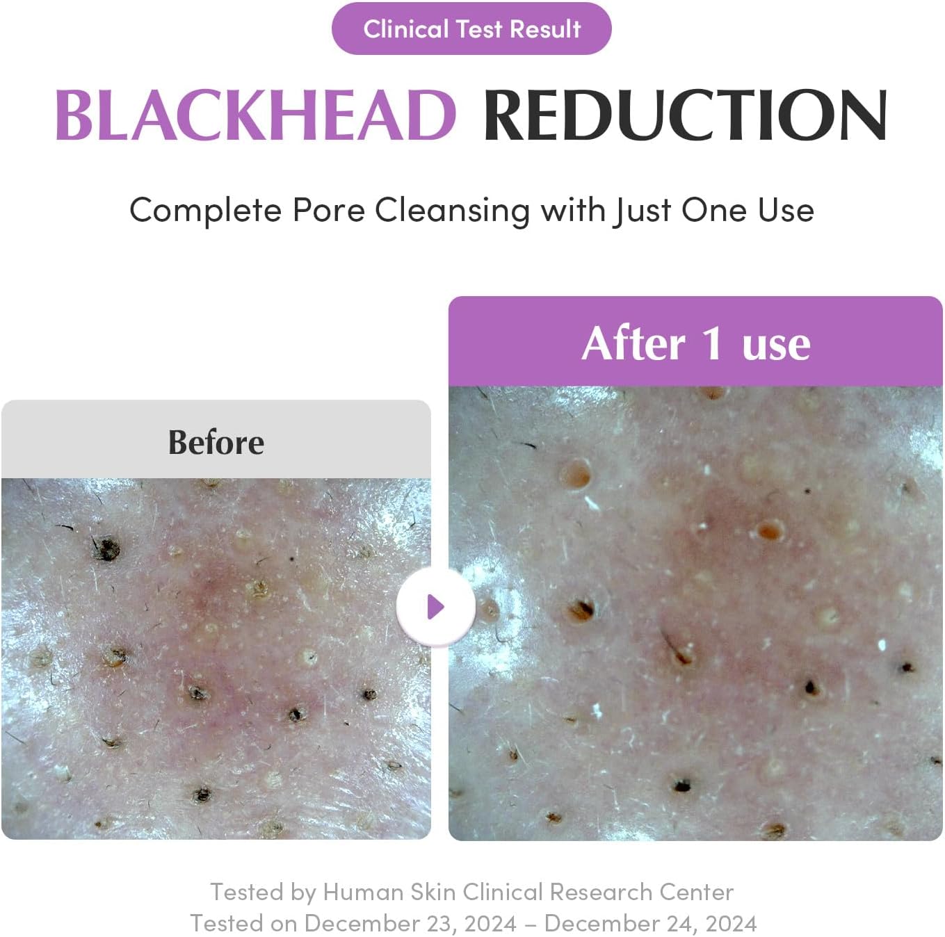 EQQUALBERRY Purple Rice Pore Purifying Pack Cleanser -130G 5