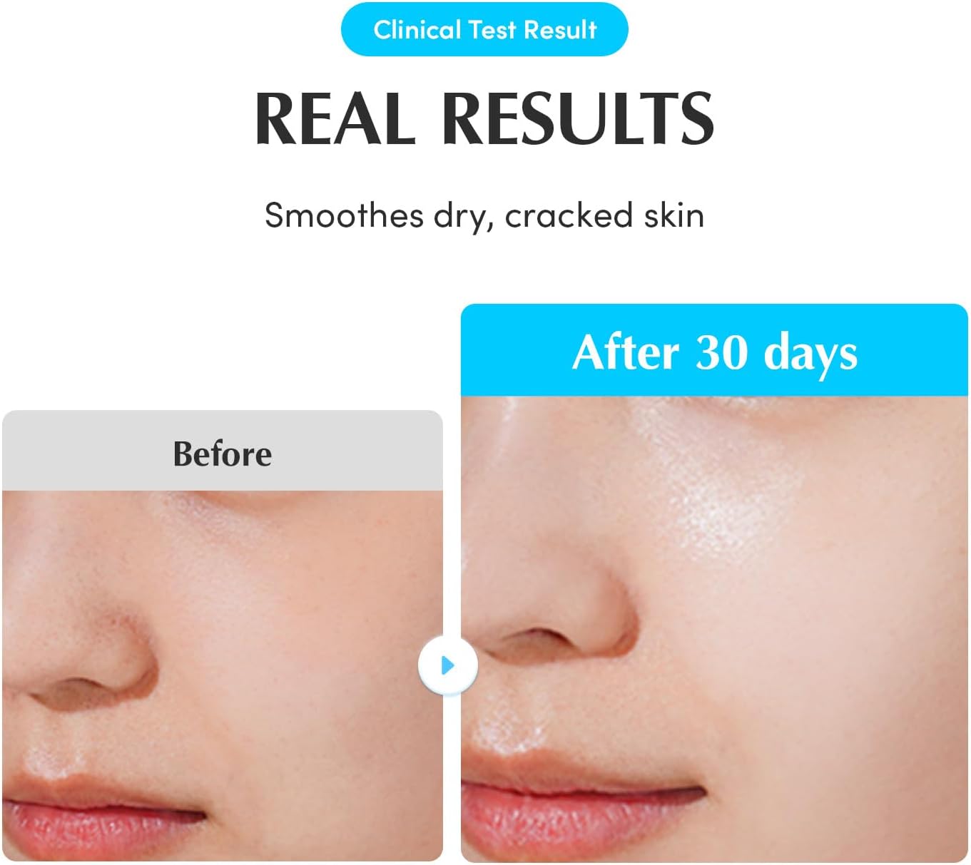 EQQUALBERRY Swimming Pool Ampoule 50 ml 5