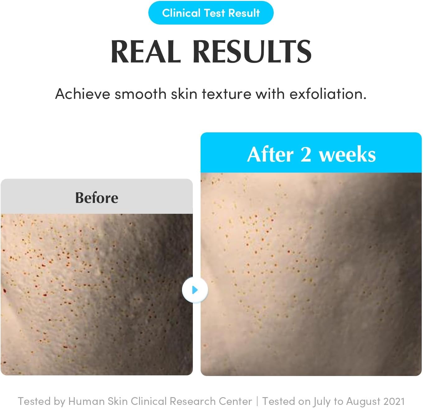 EQQUALBERRY Swimming Pool Protease Facial Toner 155 ml 5