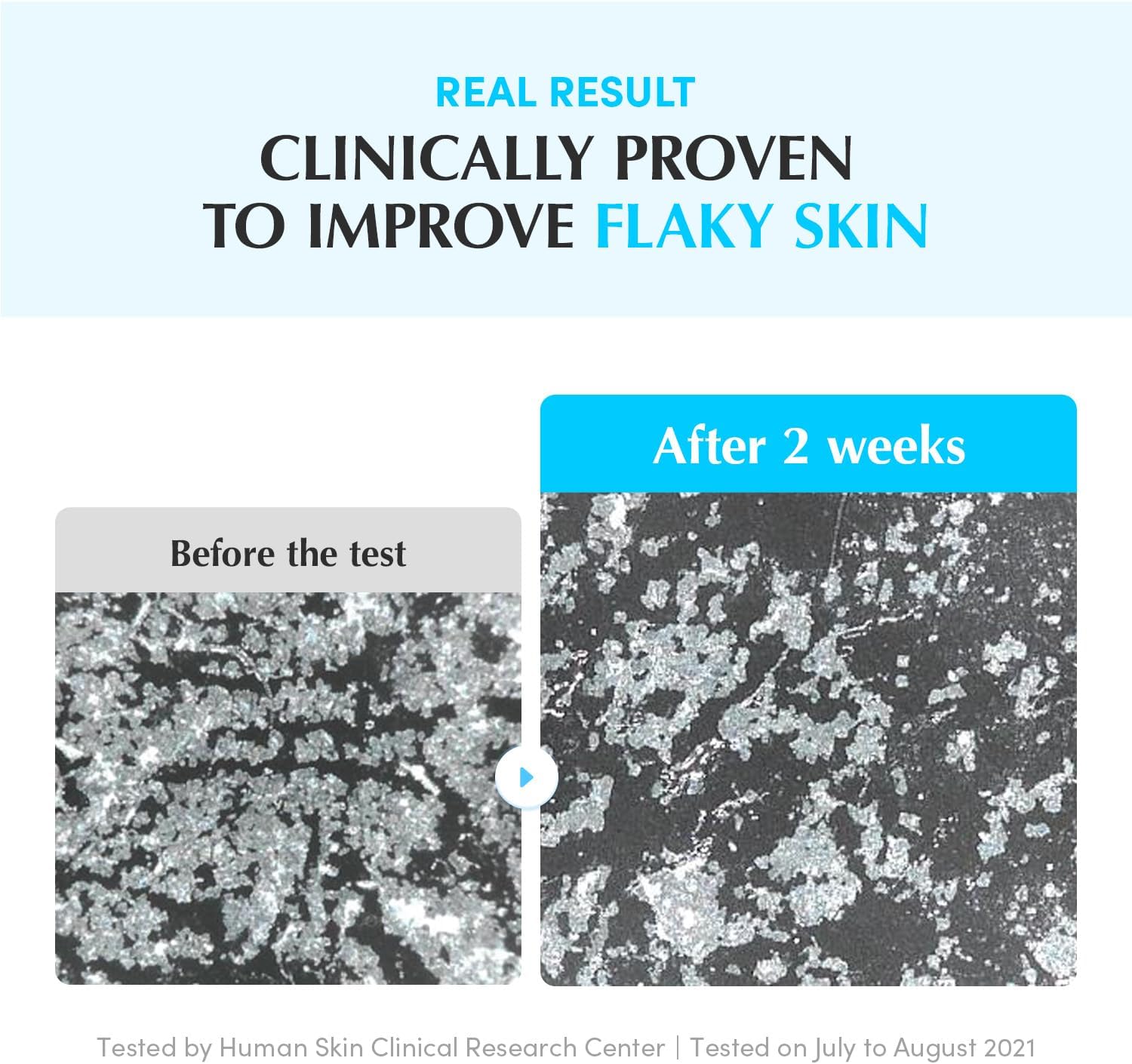 EQQUALBERRY Swimming Pool Protease Facial Toner 155 ml 7