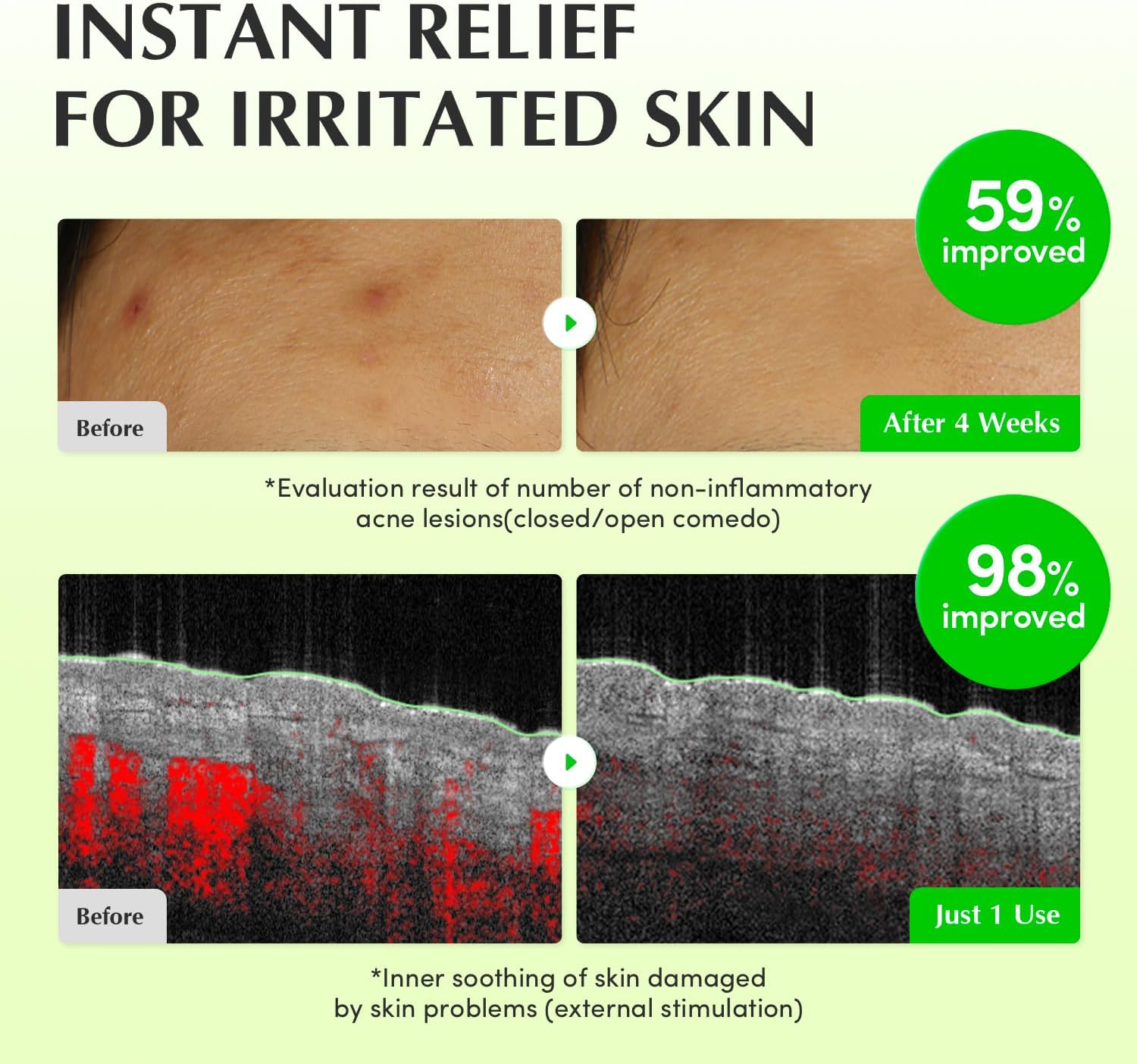 EQQUALBERRY Aloe PDRN Calming Toner 150 ml 4