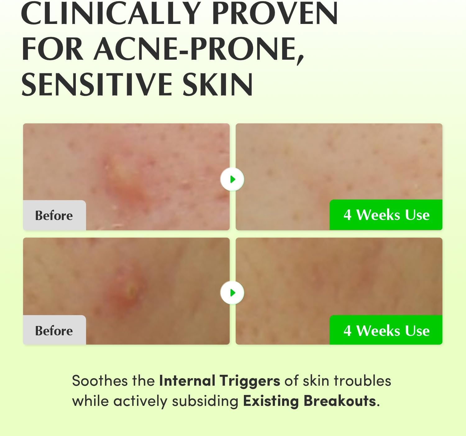 EQQUALBERRY Aloe PDRN Calming Toner 150 ml 5