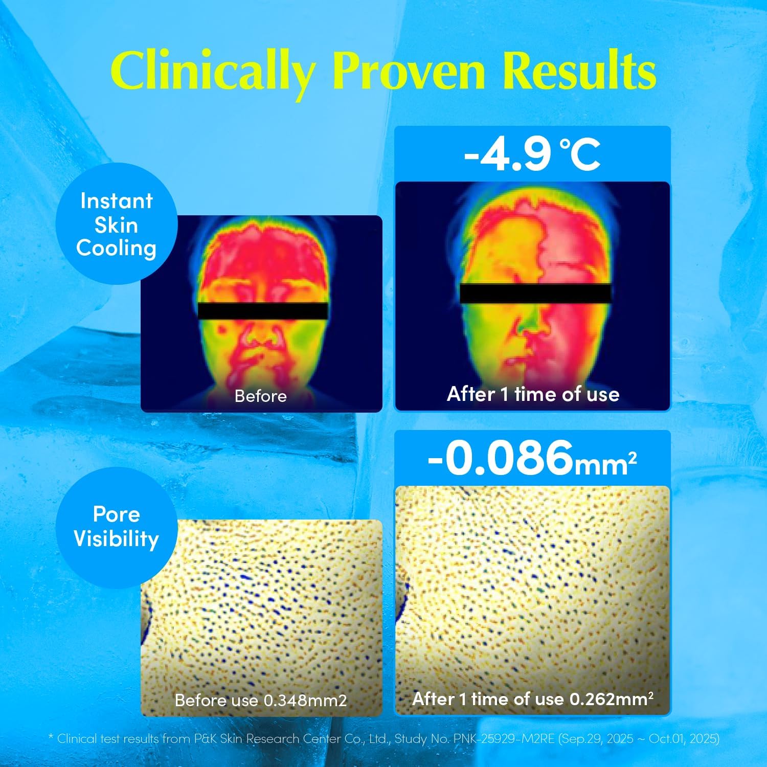 QQUALBERRY Hyaltoin Flooding Toner 150 ml – Deep Hydration Hydrogel Toner  4