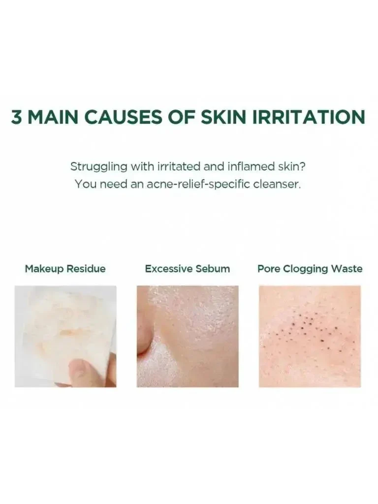 Complete Acne Relief & Hydration Set – Cleanser, Toner & Ampoule 3