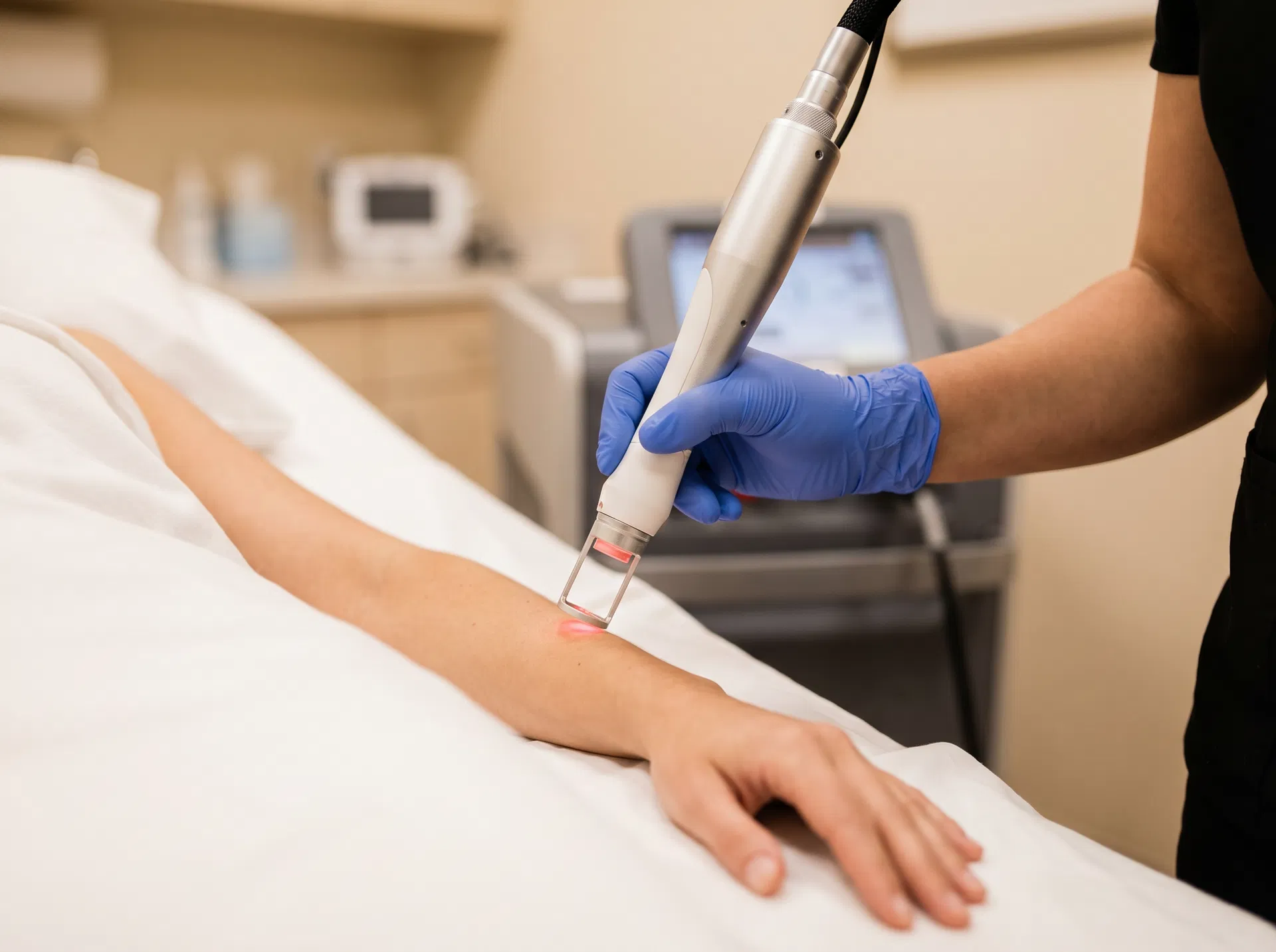 Professional laser hair removal treatment in progress