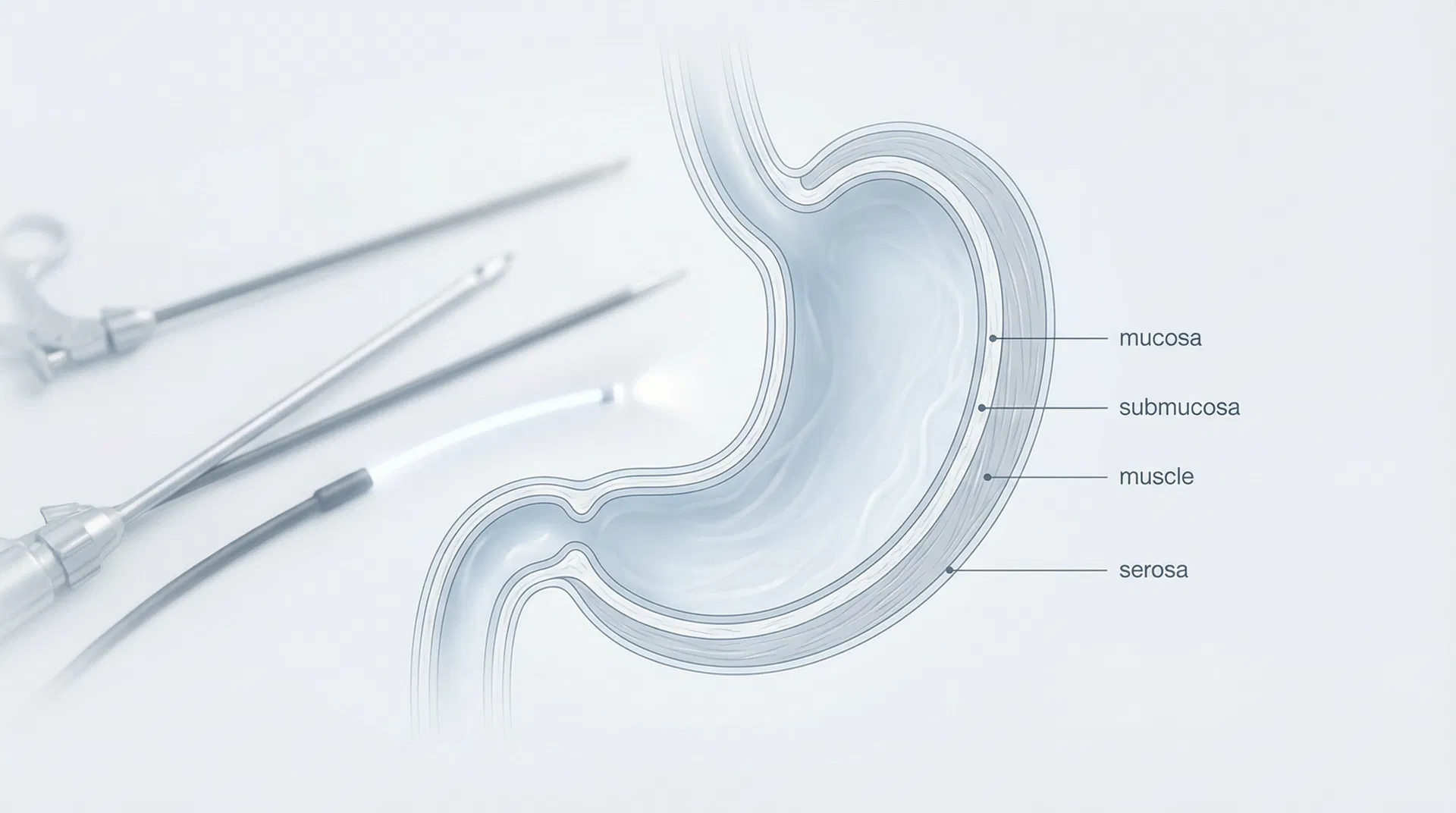 胃癌：病因、診斷與手術治療