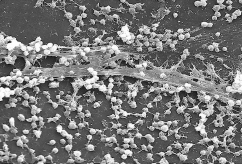 Biofilm Formation in Bacteria: How Do Microbial Communication Alters Bacterial Behavior and Antibiotic Resistance - Image 3