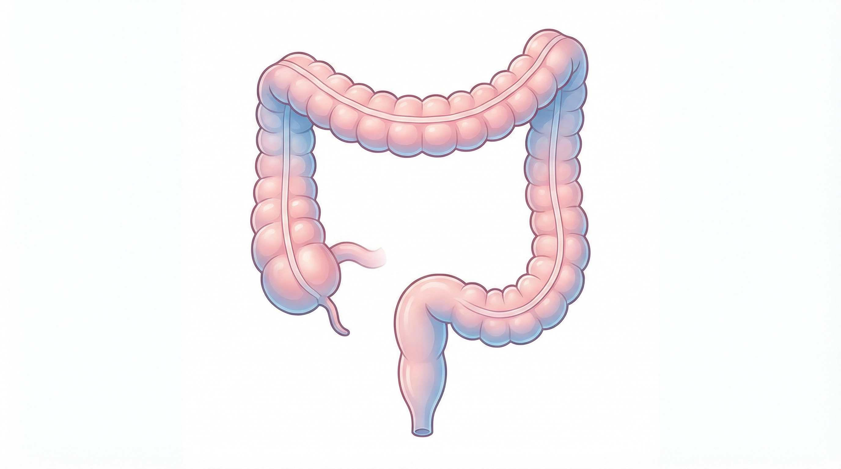 Medical illustration of Colorectal Surgery