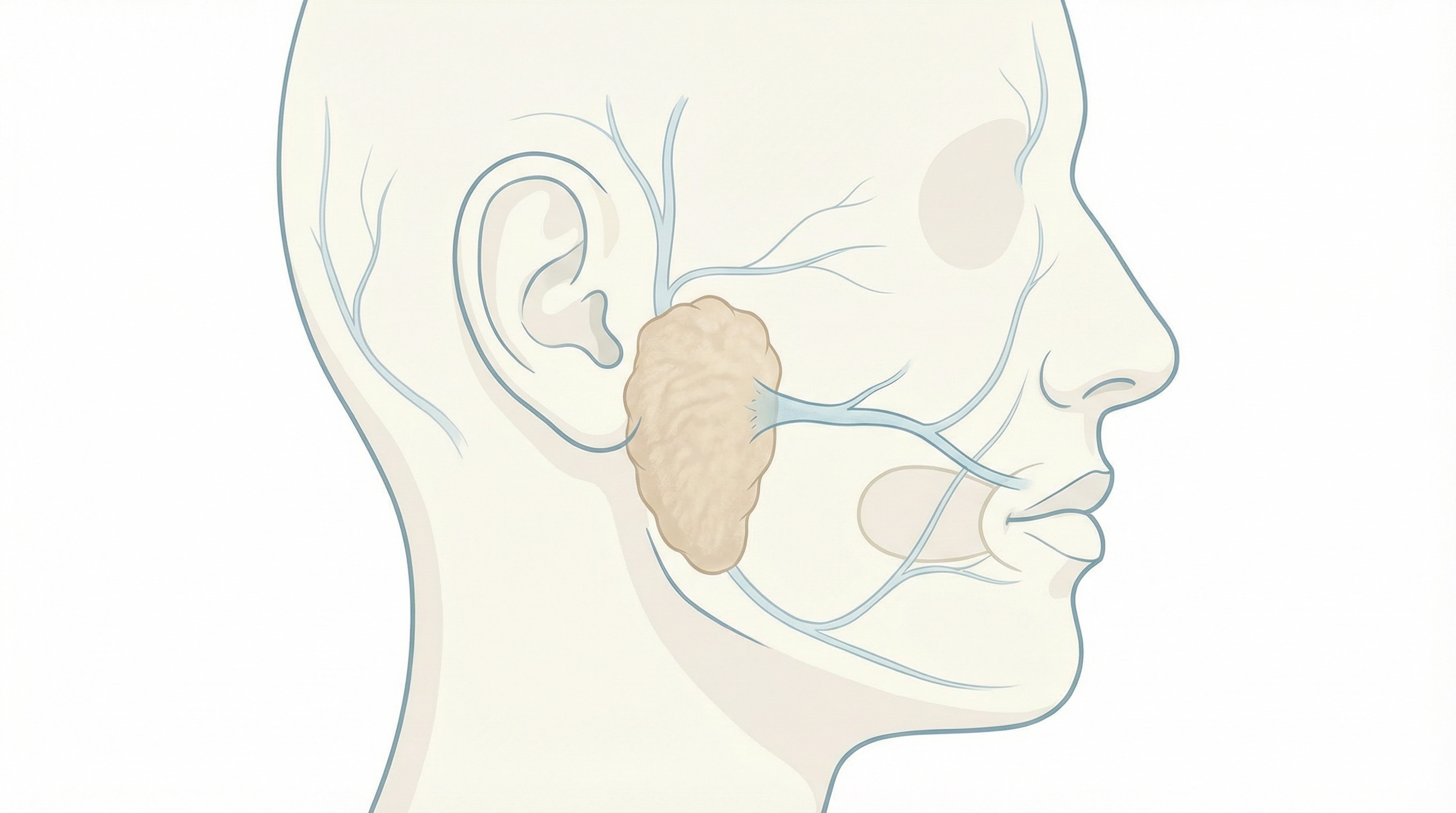 Medical illustration of Parotid Surgery