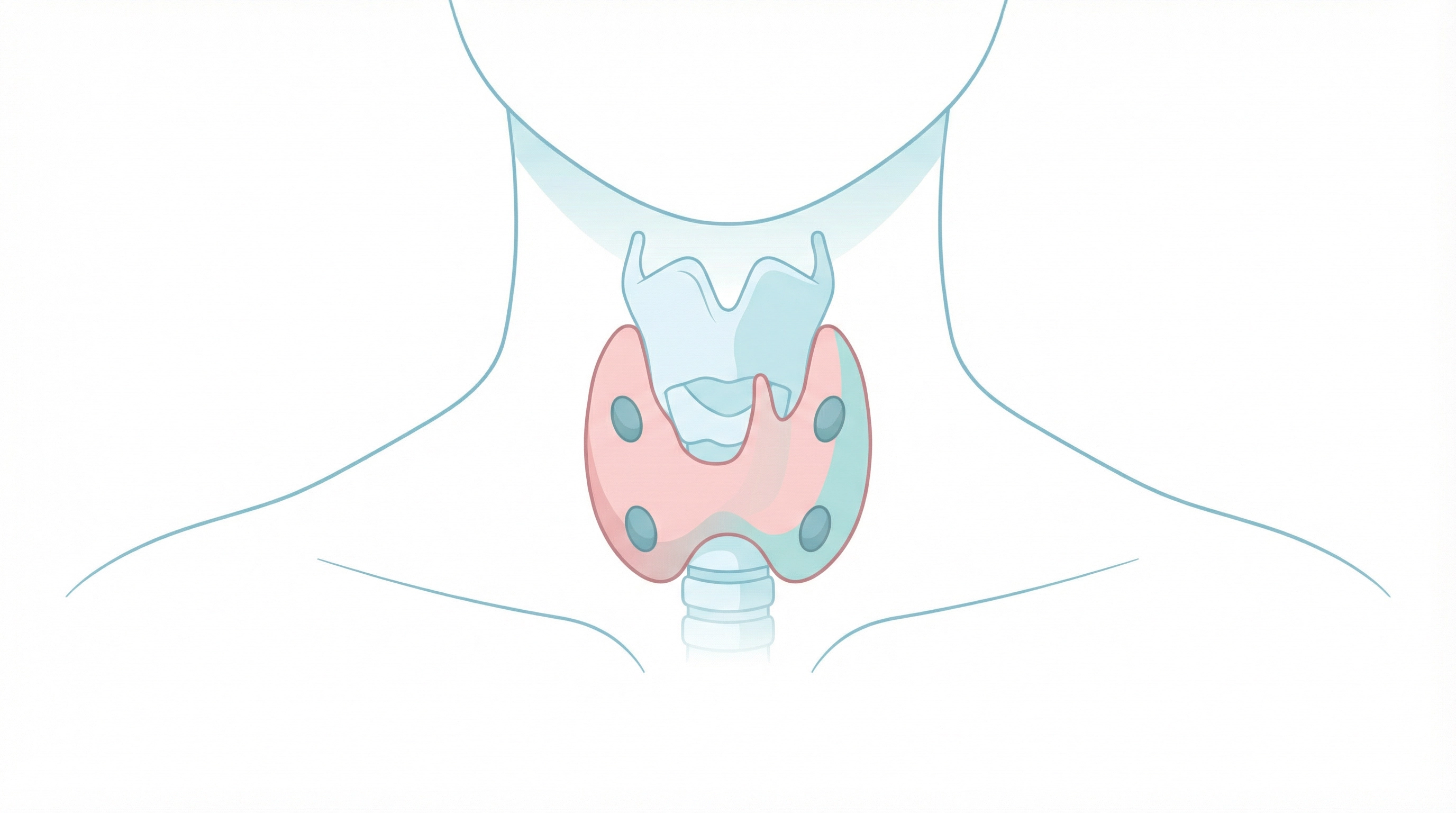 Medical illustration of Thyroid Surgery