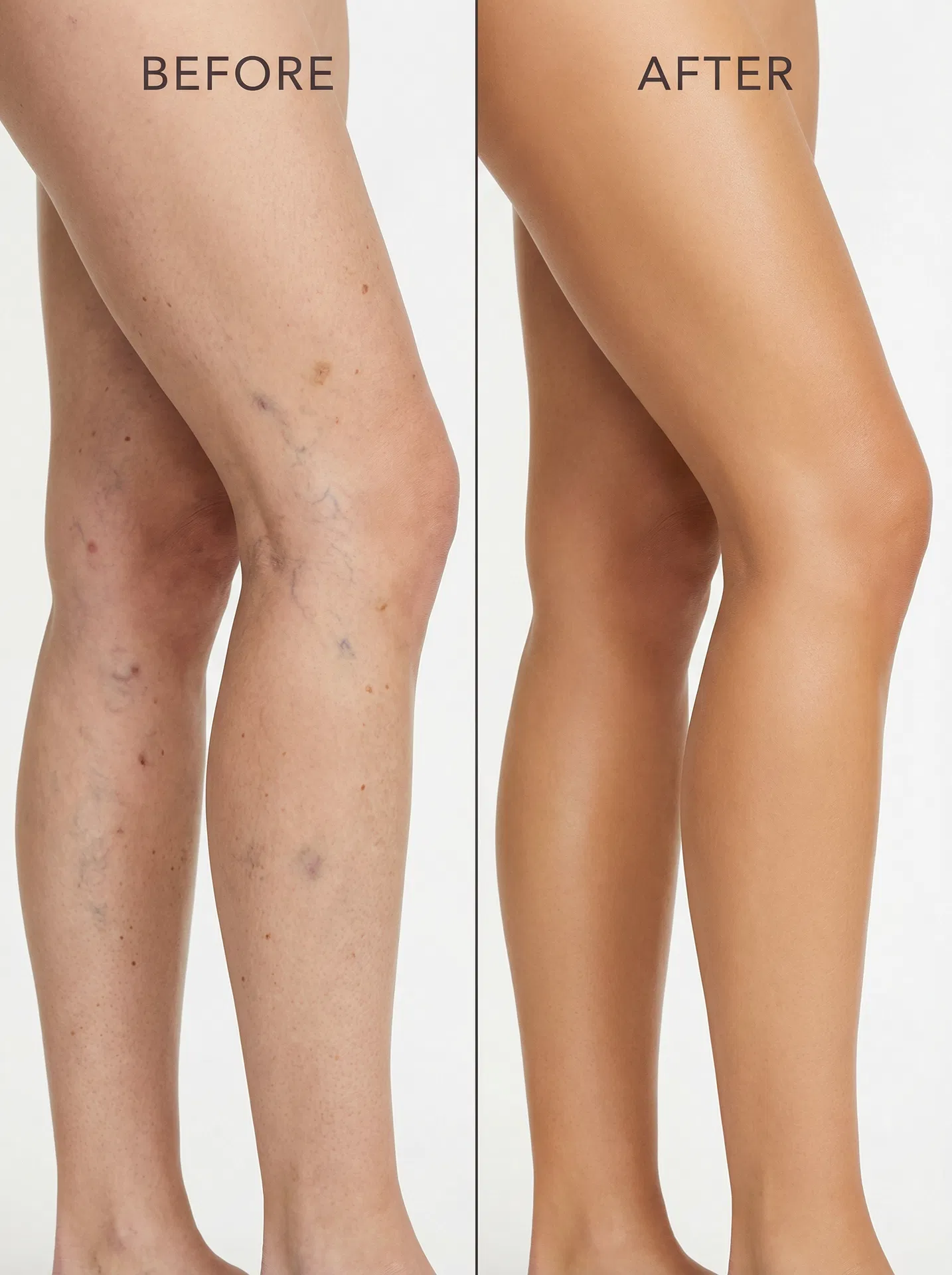 Before and after legs transformation