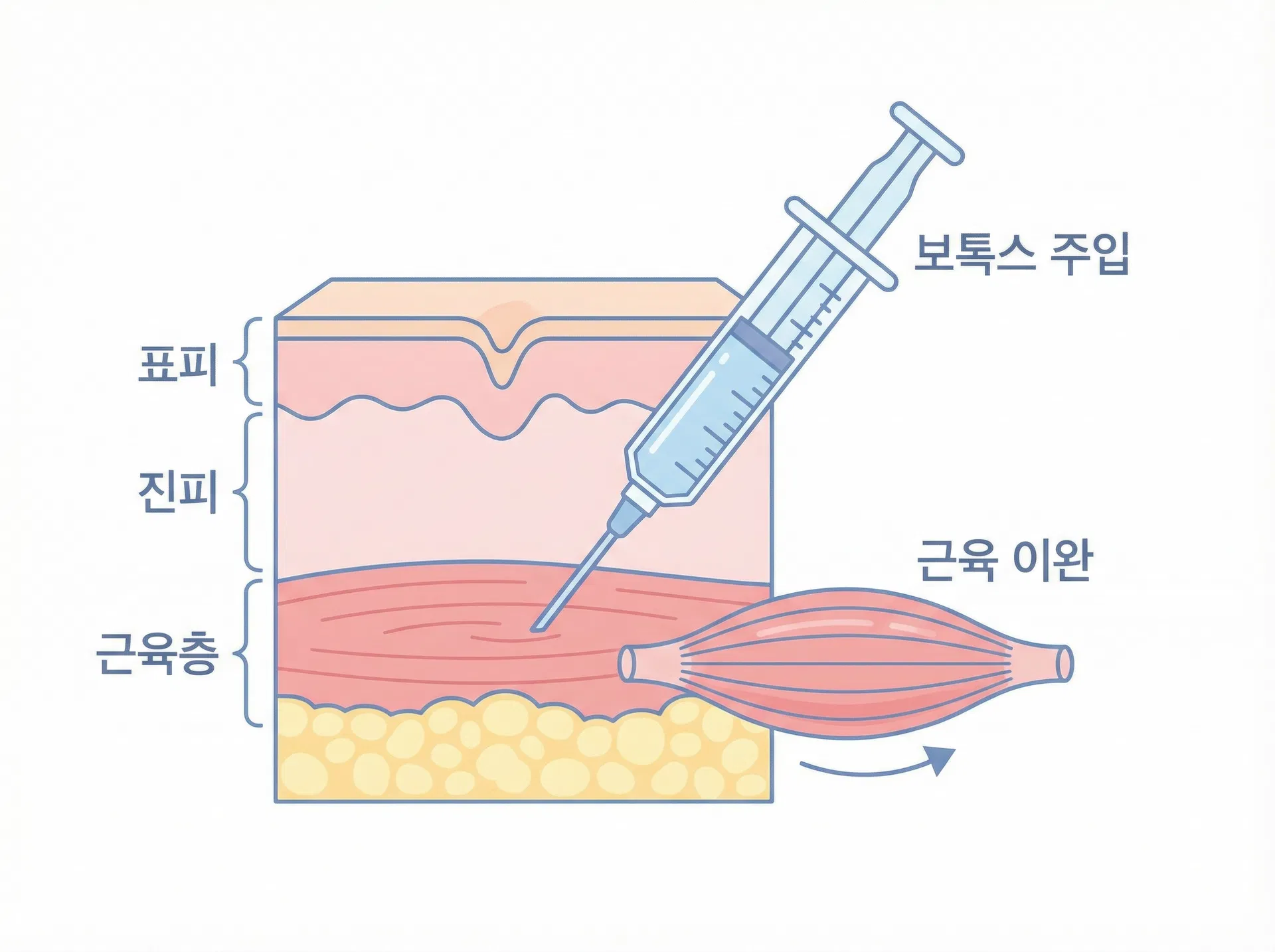 에디션성형외과 피부시술