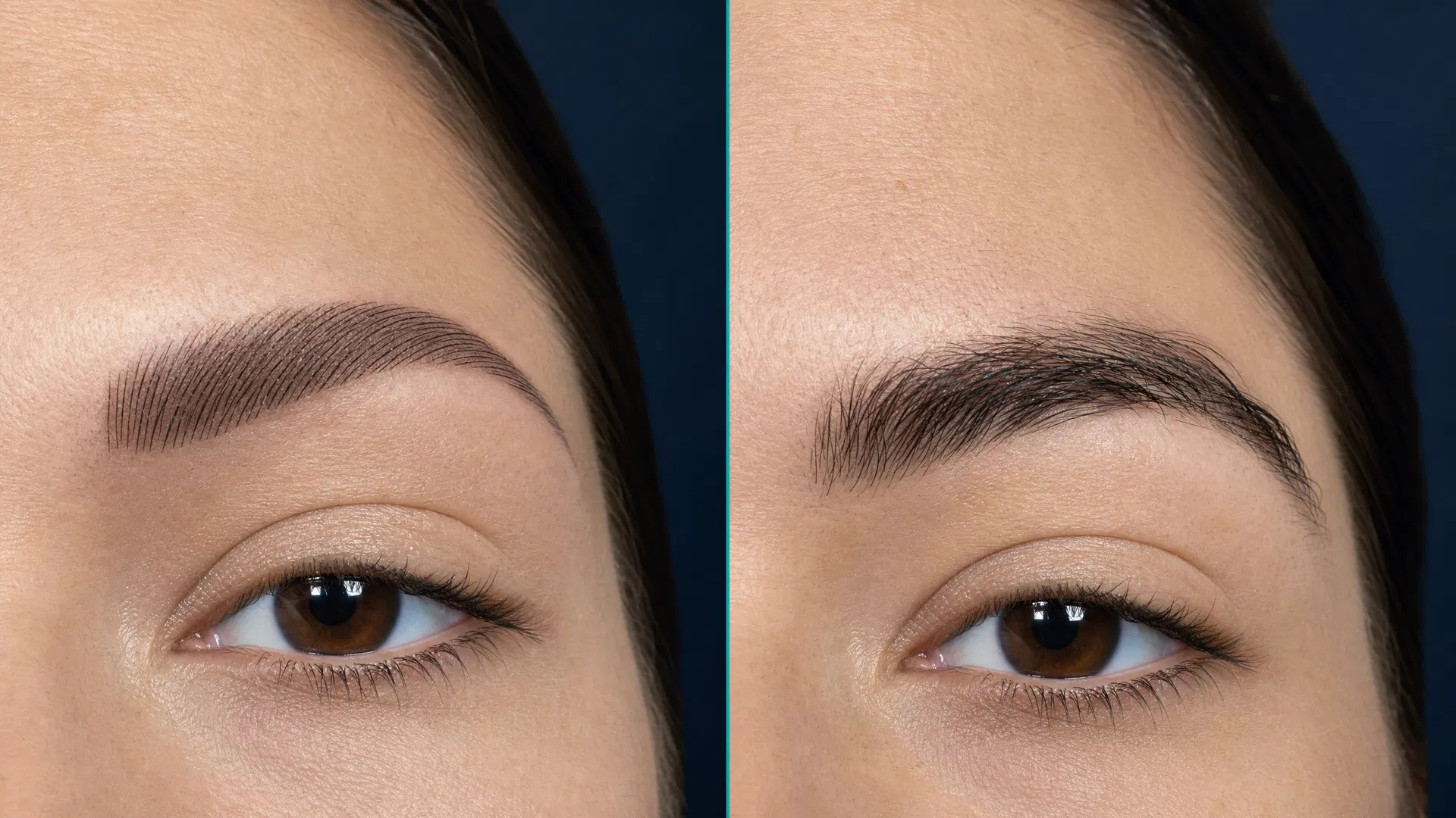Split image comparing eyebrow microblading and natural eyebrow transplant results