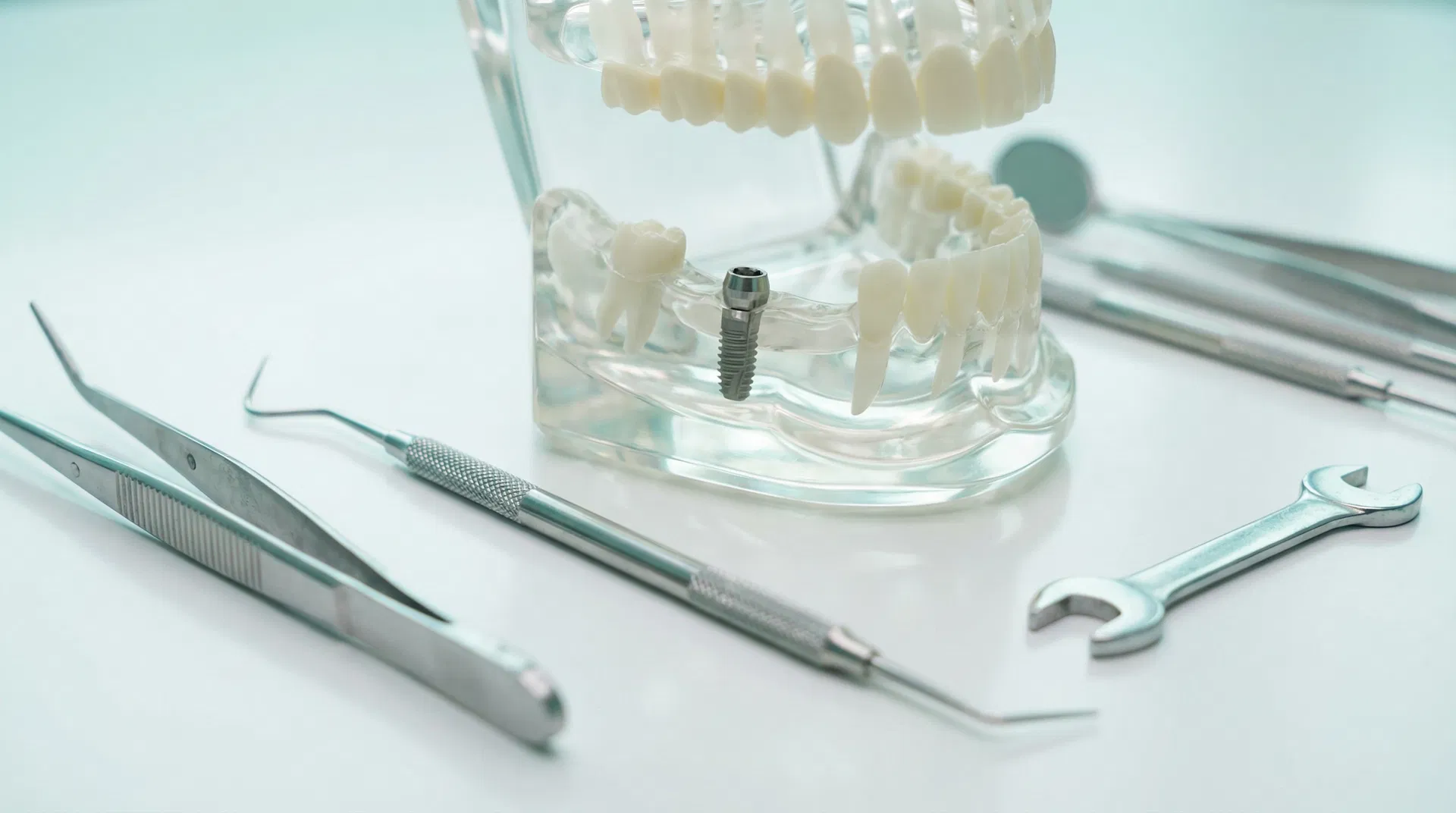 Advanced dental implant technology at Houston Oral Surgery