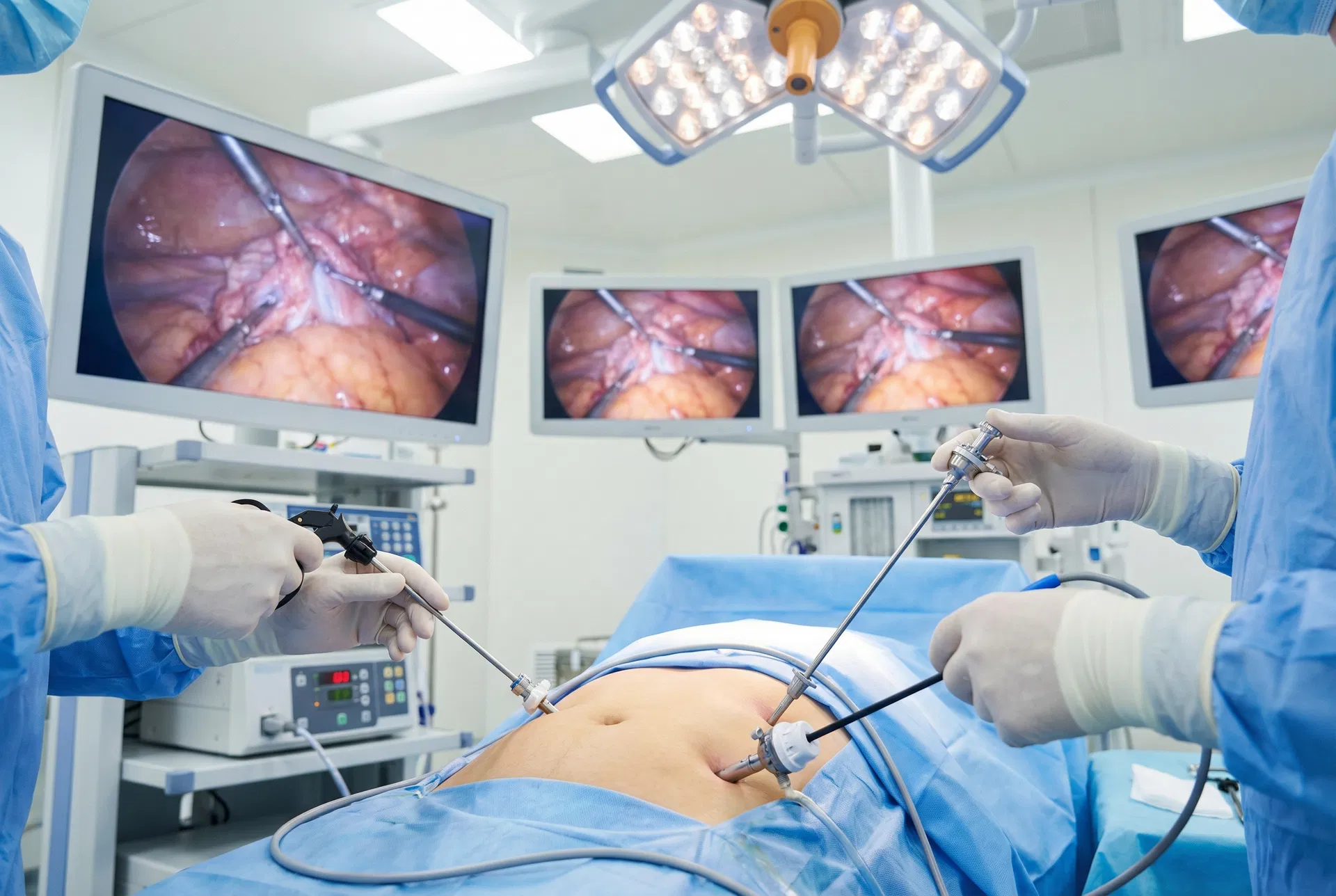 Minimally Invasive Surgery