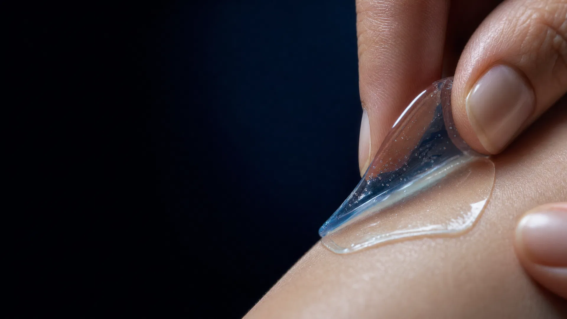 Hydrogel wound dressing being applied
