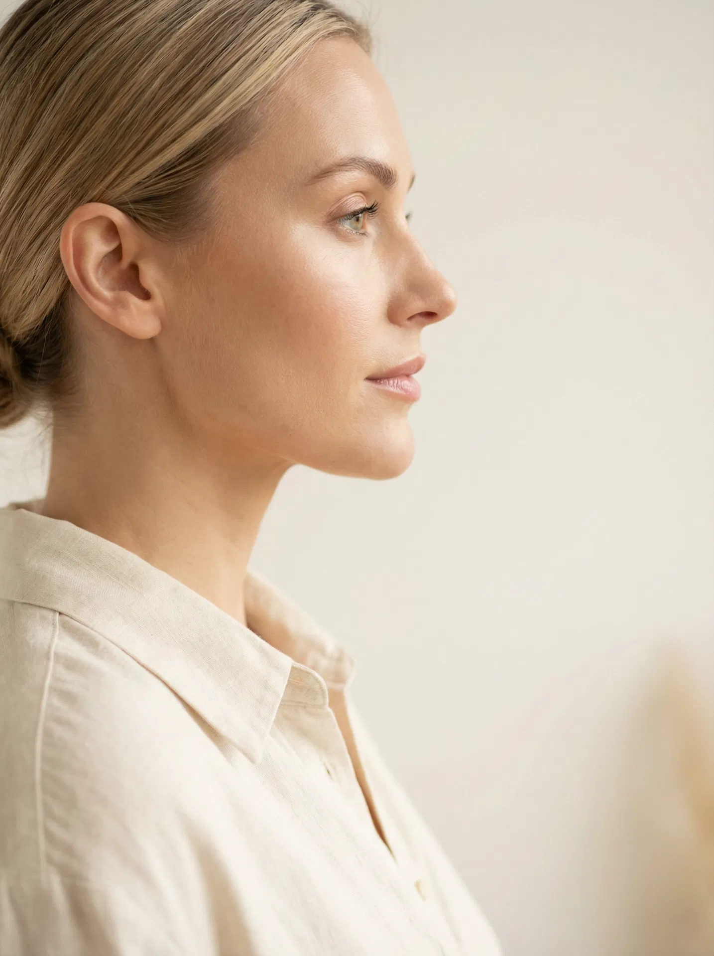 Synlig resultat etter Belkyra-behandling mot dobbelthake – slankere hakekontur og definert profil