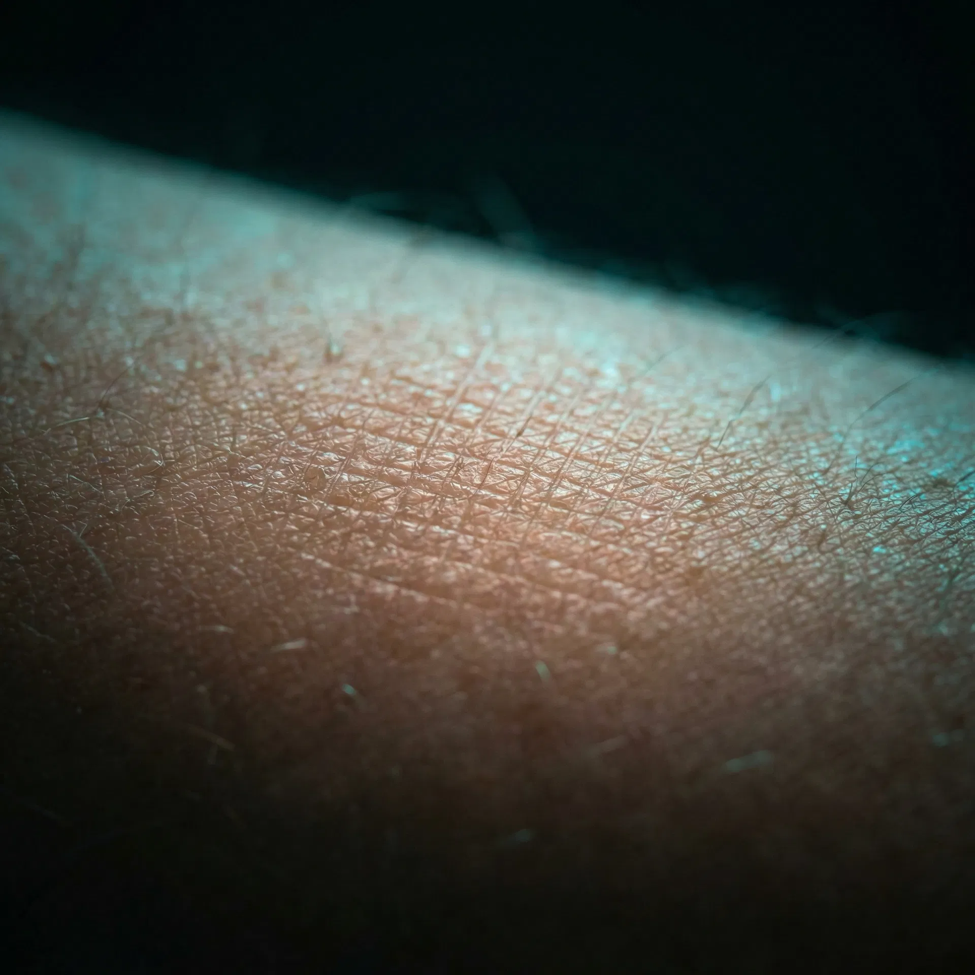 Hudtekstur etter Morpheus 8