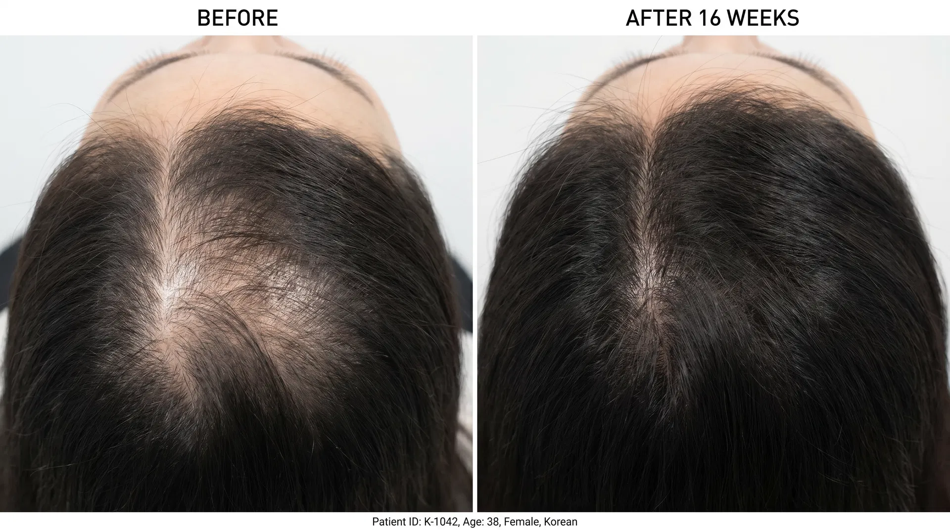 Before/After Case 3
