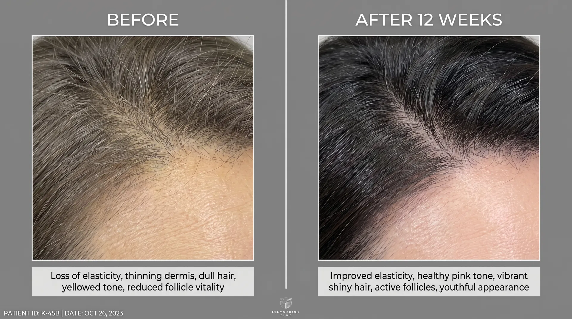 Before/After Case 4