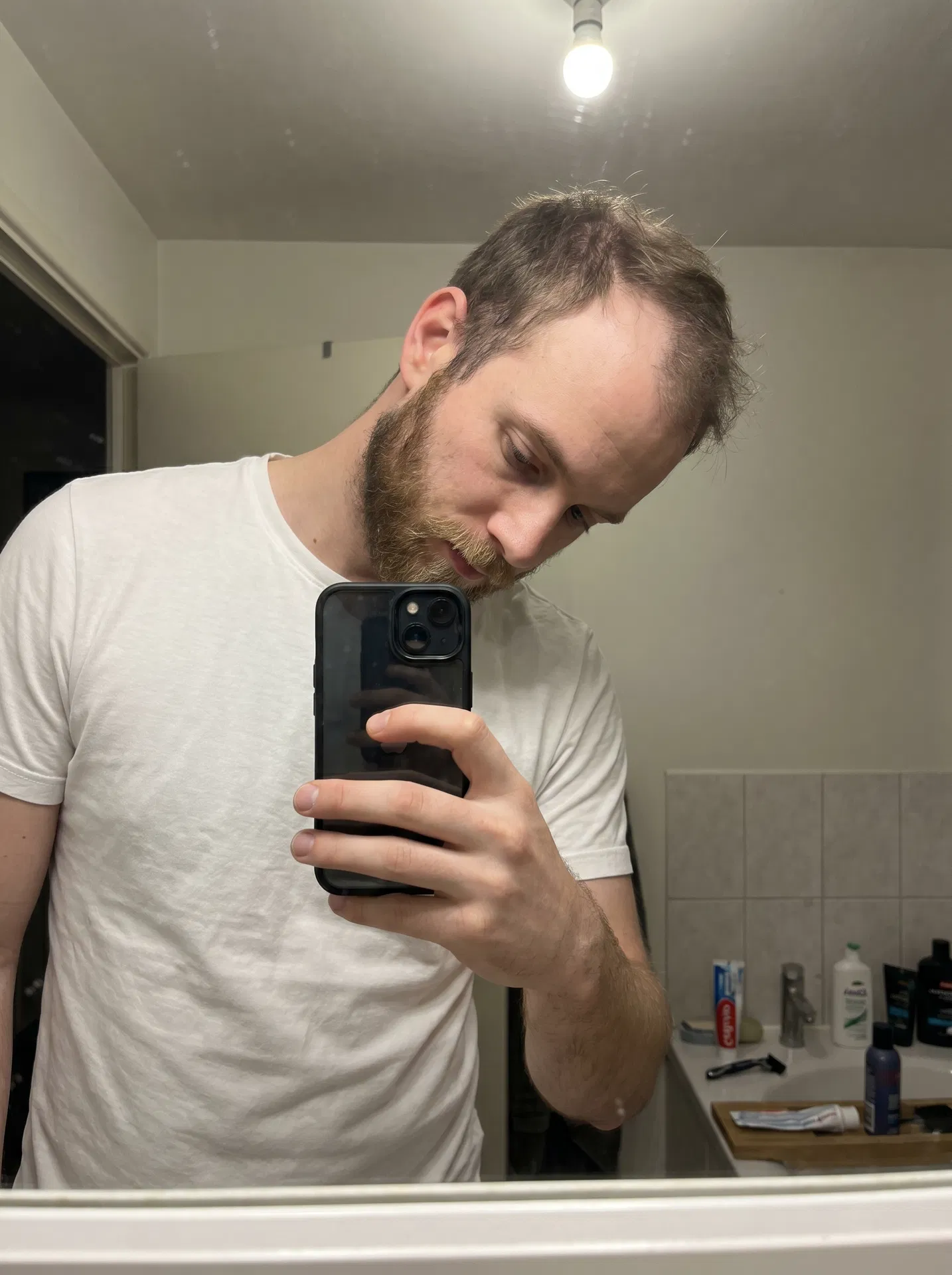 Vor der Behandlung – Badezimmer-Selfie mit Geheimratsecken