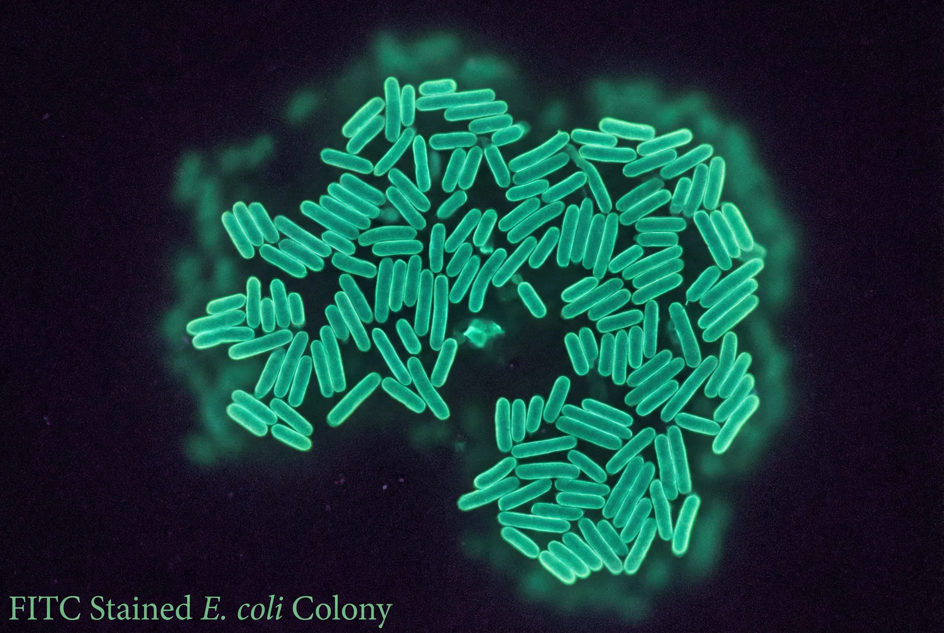 The Silent Pandemic: Understanding Antibiotic Resistance