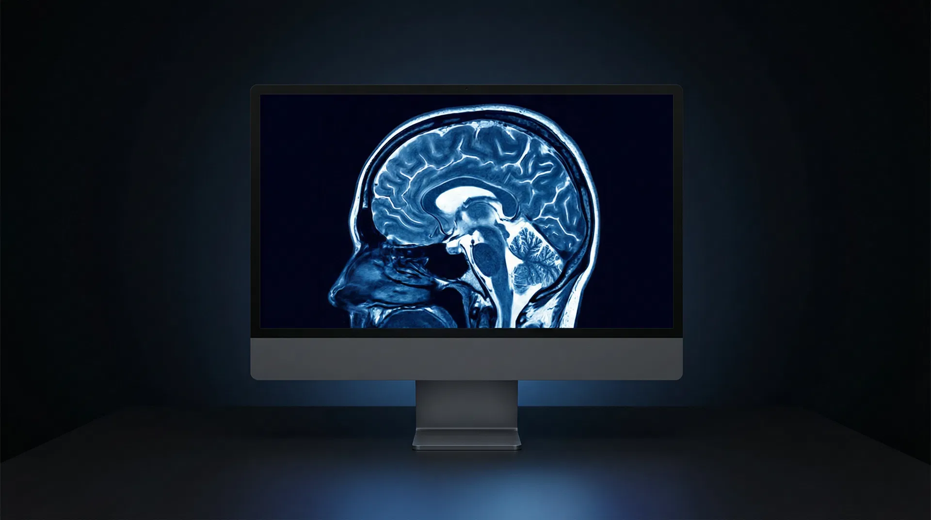 High-resolution MRI brain scan