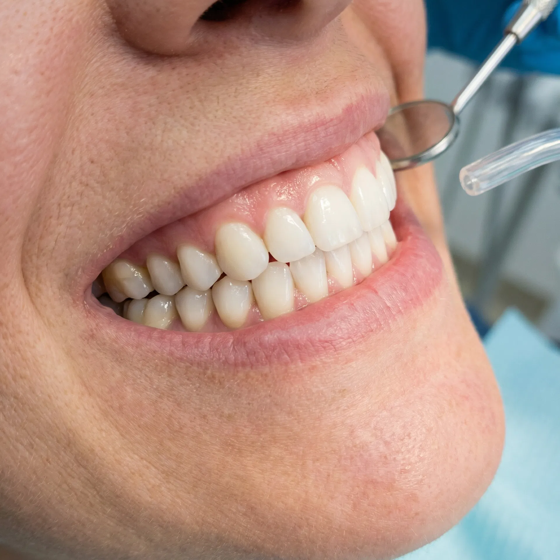 Depois do tratamento de Clínico Geral em Peruíbe-SP