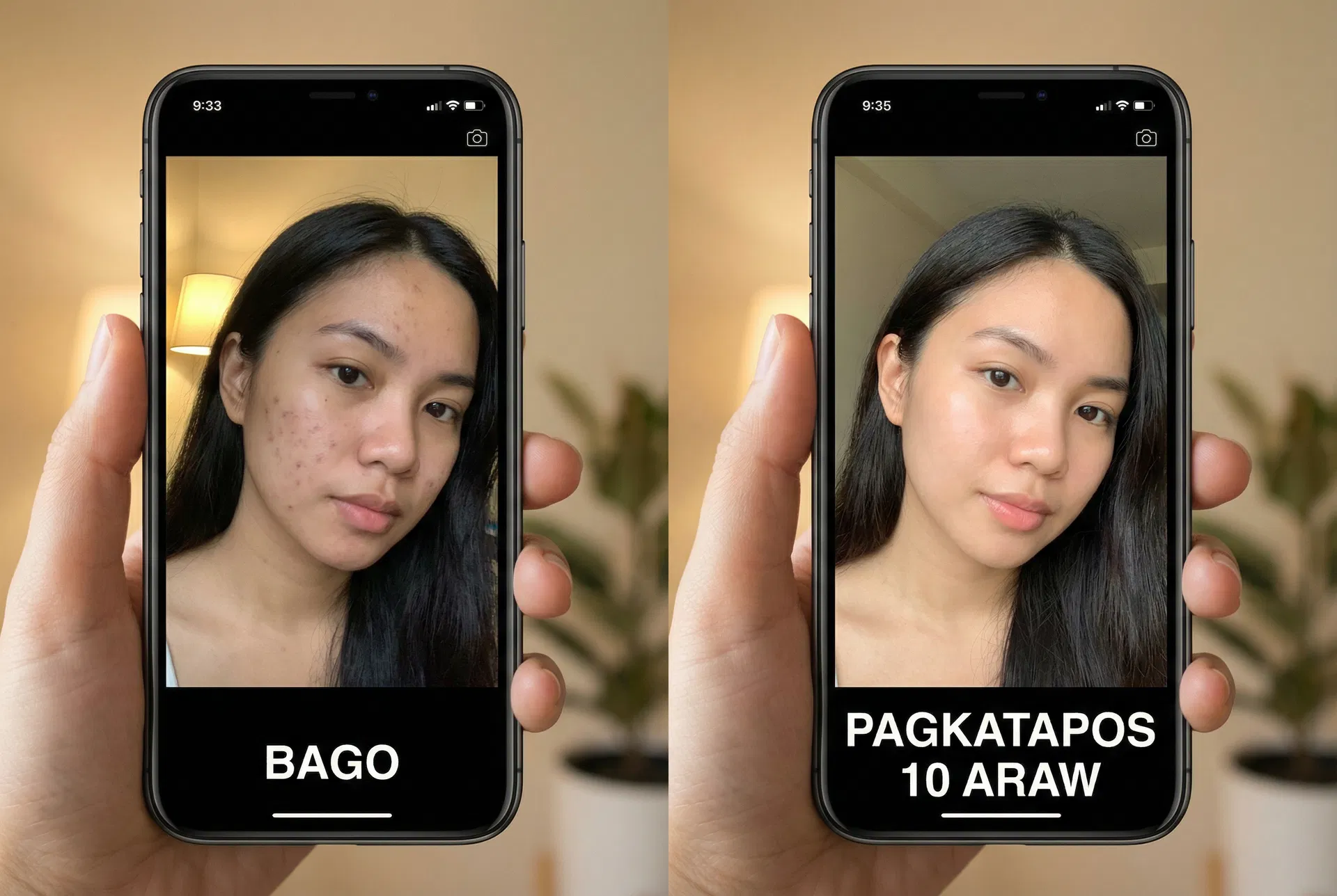 Ana Cruz before and after