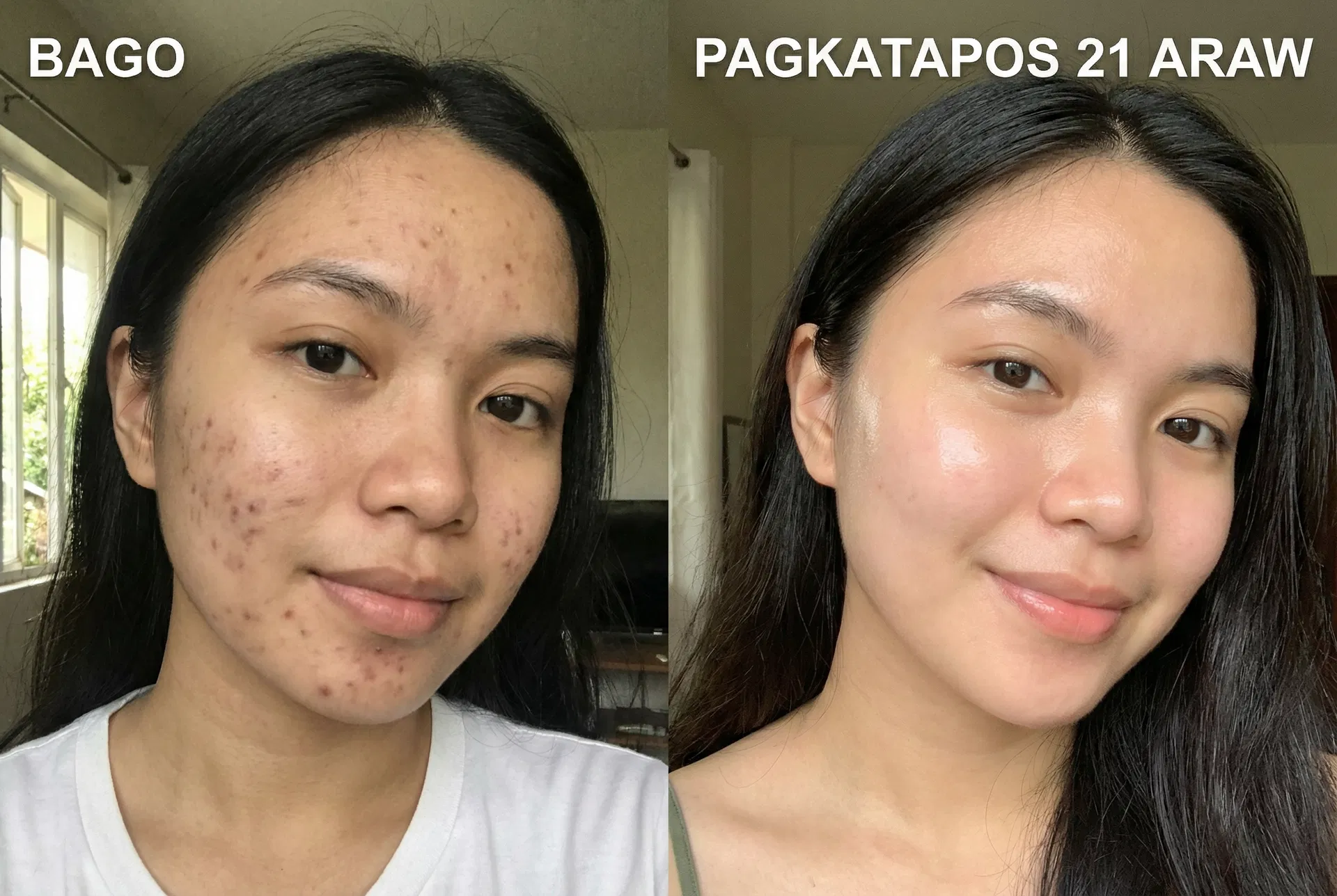 Lovely Dela Rosa before and after