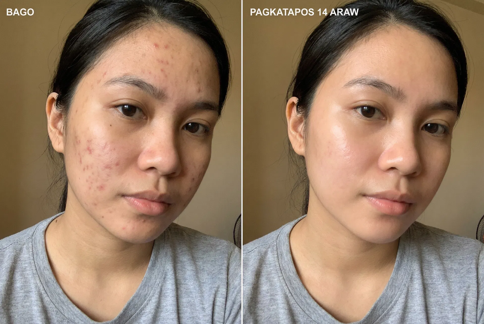 Maria Santos before and after