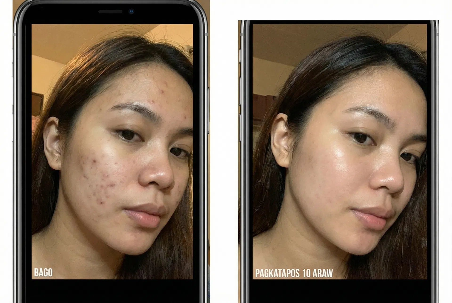 Rachel Mendoza before and after