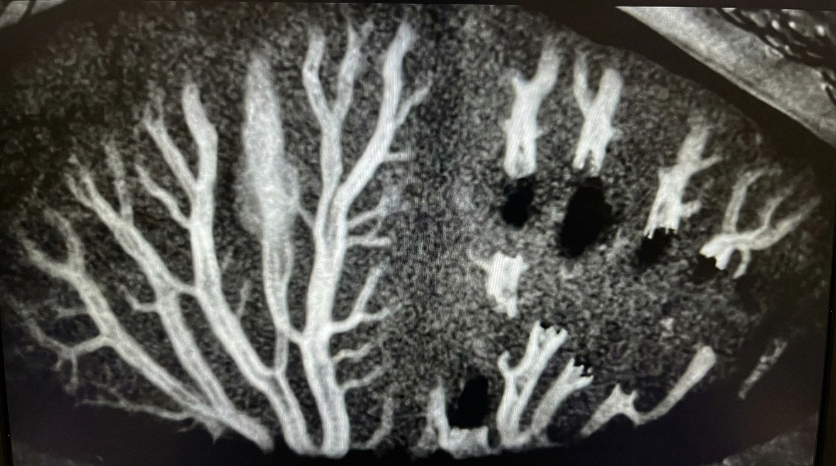 Eye doctor performing a comprehensive dry eye evaluation in Fayetteville NC